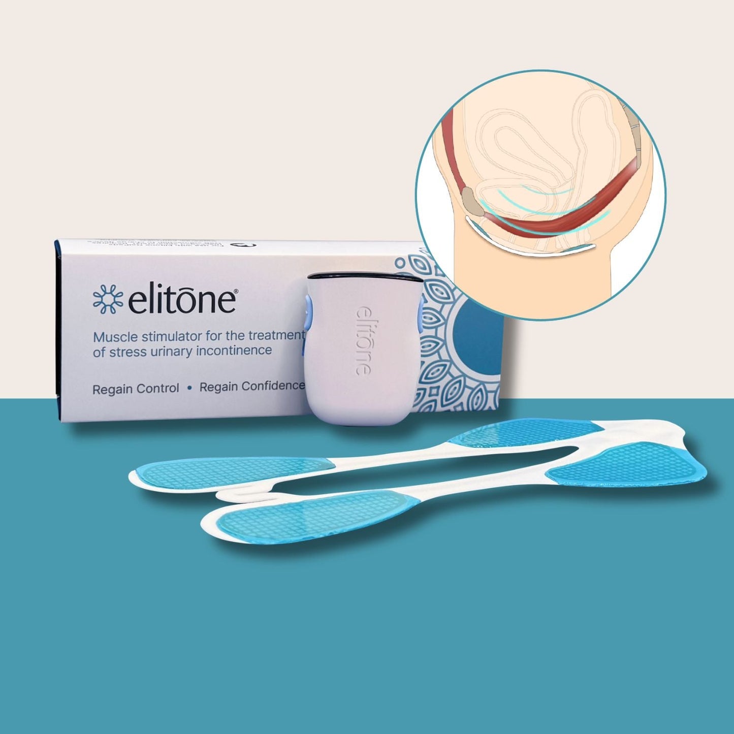https://cdn.shopify.com/s/files/1/0681/5016/5733/files/EK1042_Kit_PF_graphic.jpg?v=1771602311